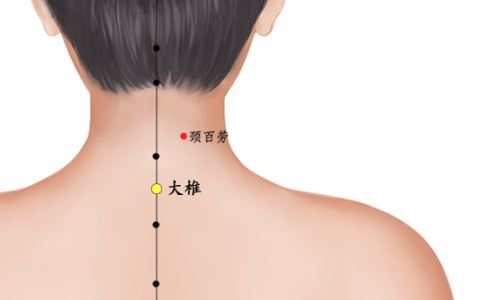 痤疮怎么治疗 及时早期治疗很重要(图2) 痤疮怎么治疗 常见治疗痔疮的方法有哪些 中药如何治疗痤疮